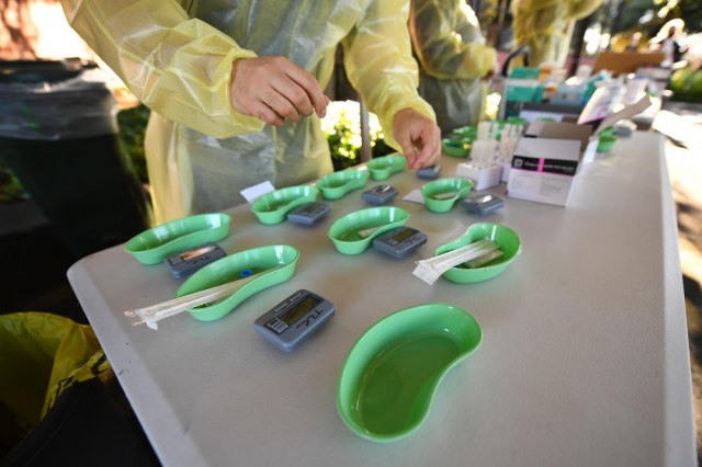 Brzi antigenski ili PCR test: Koji je pouzdaniji?